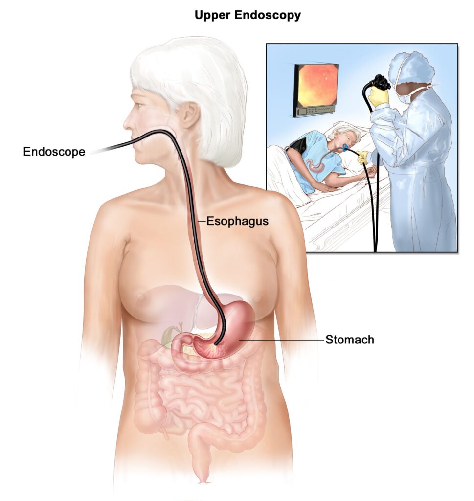 Gastroenterology Endoscopy