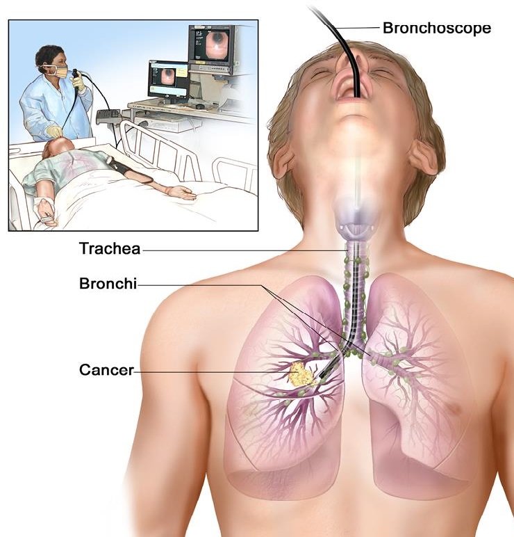 Pulmonology & Bronchoscopy